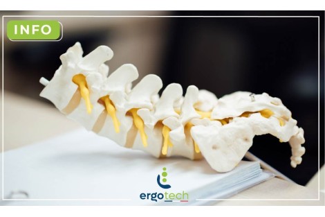 Herniated Disc: Causes, Symptoms and Solutions